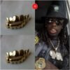 Gold Teeth Grills