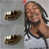 Gold Teeth Grills